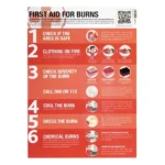 First Aid for Burns Guide